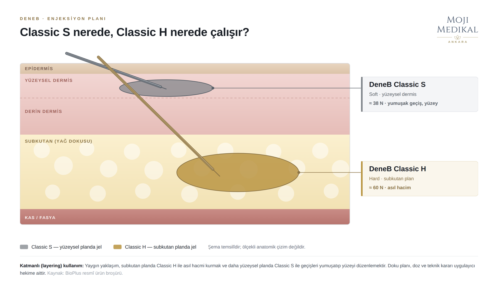 DeneB Classic S yüzeysel dermis, Classic H subkutan plan enjeksiyon şeması